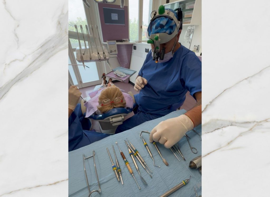 Come coprire i denti rovinati