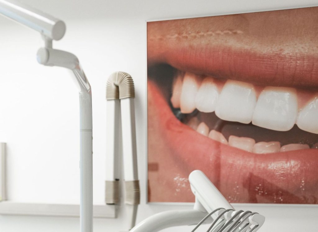 Faccette dentali: solo dall’odontoiatra o anche in farmacia? 2 faccette dentali a Novara e Varese