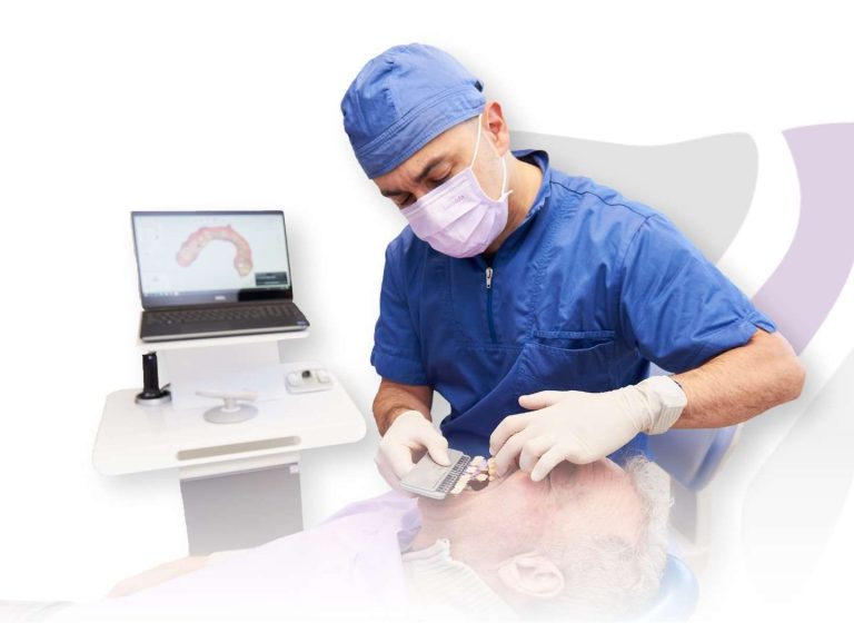 Faccette dentali a Novara e Varese