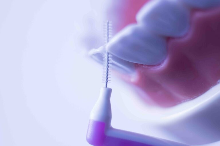 Glossario Igiene Orale e Parodontologia