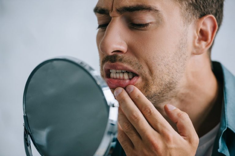 Blog 15 denti che si muovono e spostano