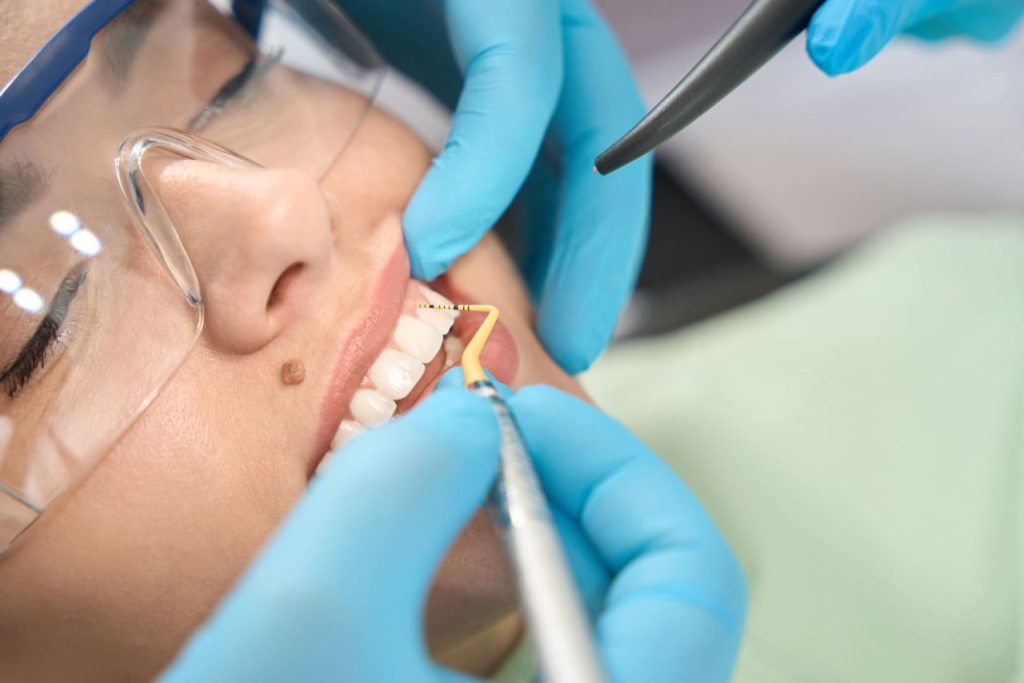 Cosa mangiare con i denti sensibili? Le cause da conoscere e i consigli utili 1 denti sensibili cause