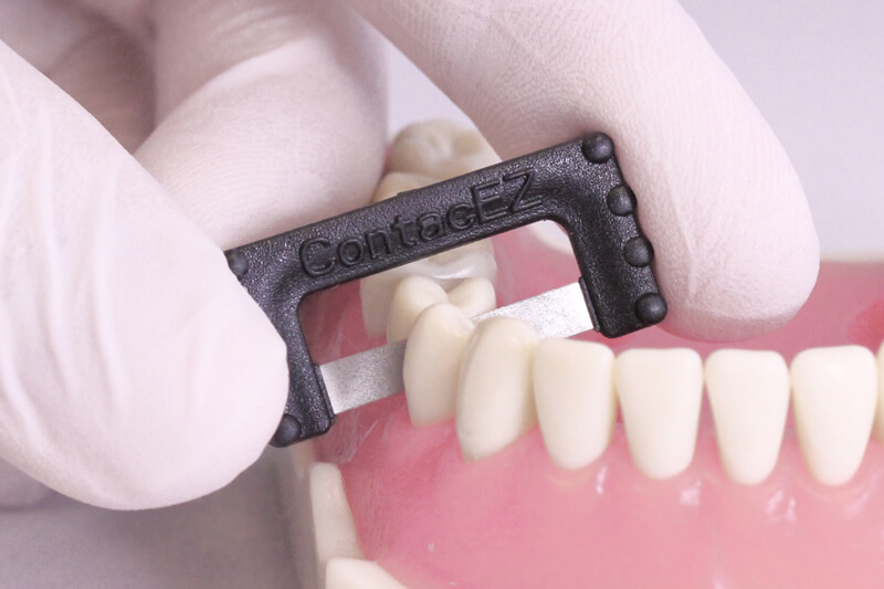 Stripping dentale e Invisalign®: quando è necessario? 1 Stripping dentale